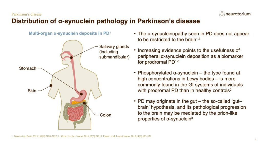 Distribution of α-synuclein pathology in Parkinson’s disease